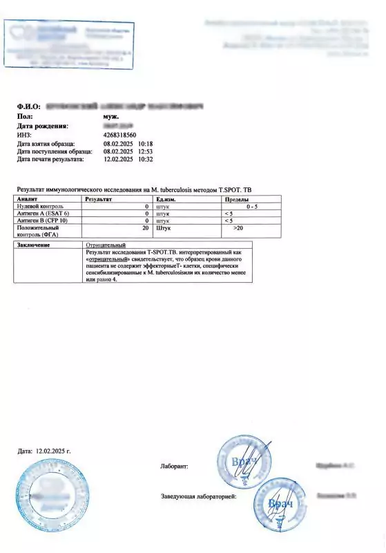 Купить анализ T-spot в Москве.
